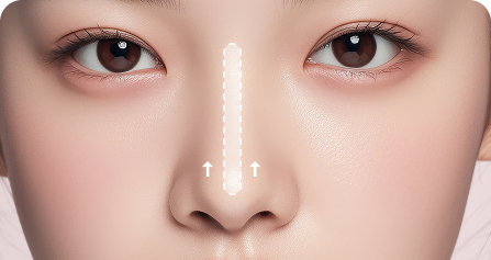 구축에 의한 경우